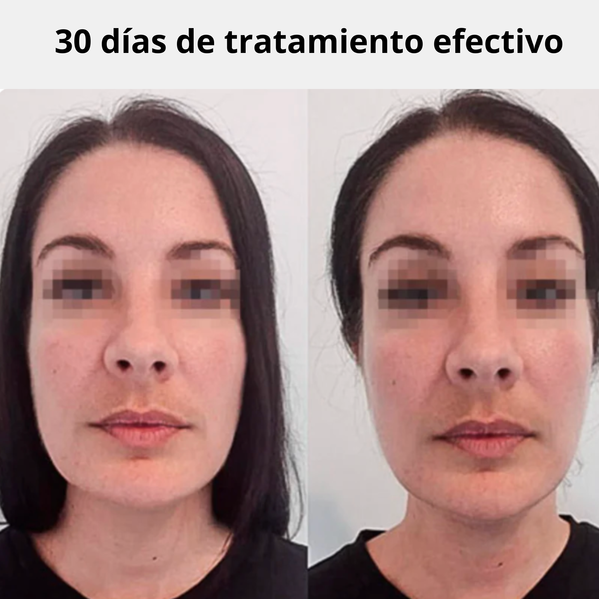 Drenaje Linfático Líquido -  Reduce la hinchazón y recupera tu contorno